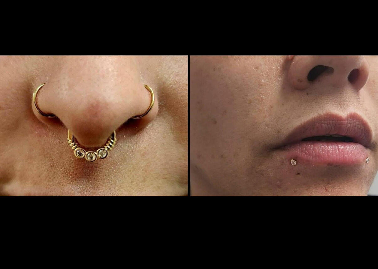 Zen'Art – Clinique dépilation laser, piercing et détatouage à Donnacona Clinique Zen'Art à Donnacona – services de laser et piercing